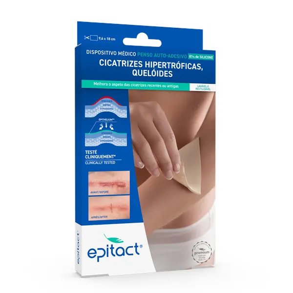 Epitact Penso Cicat Quelóides Hipertróf